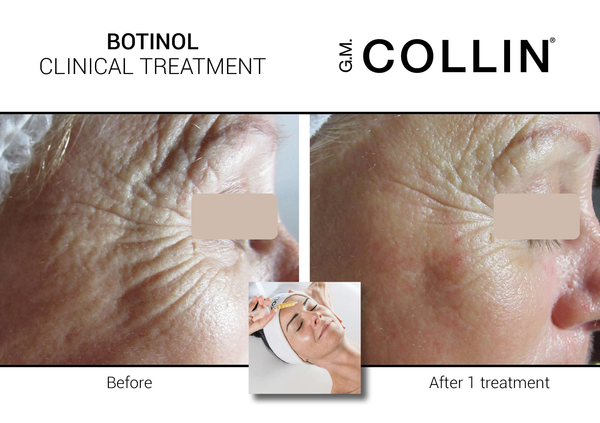 BeforeAfter-Clinical-PostCard